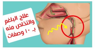 بدون أدوية ١٠ وصفات عالج بها نفسك من البلغم
