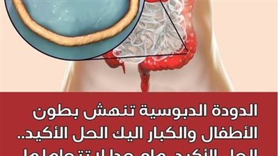  أعراض وطرق علاج ديدان البطن