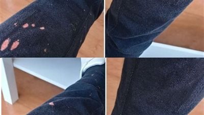 ١١ فكرة تساعدك في كيفية ازالة بقع الكلور من على الملابس