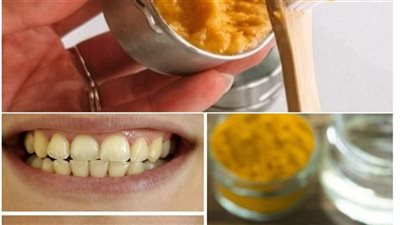 خلطات زيادة بياض الأسنان بالكركم