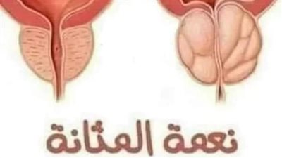 تمارين علاج ضعف المثانة 5 وضعيات بسيطة للمبتدئين