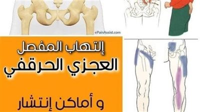 كيف تتخلص من آلام أسفل الظهر ؟