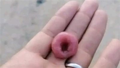 قصة واقعية .. دود يخرج من منزل عروس وعريس ولن تصدق مالسبب
