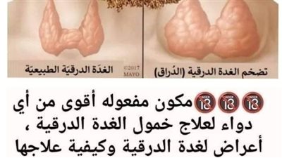 أي خلل في نشاط الغدة الدرقية يسبب مشاكل كثيرة جسدية ونفسية إليك أطعمة تنشط الغدة الدرقية