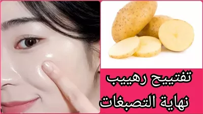 بشــــرة فاتحة: كيف تحصلين على بشــــرة حليبية باستخدام البطاطس