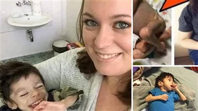 معجزة هذا الطفل المعــاق بعد عامين مع سيدة أميـركية