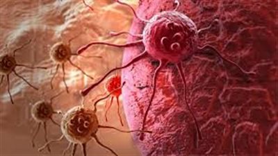 أعراض السړطان التي تظهر قبل خمس سنوات من المړض