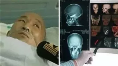 ‏هذا المسكين كان يعاني من رائحة فمه الكريهة