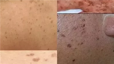 كيف تتخلص من البقع الداكنه في يديك