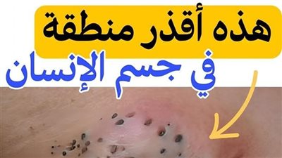 هل تعرف ما هي أقذر منطقة في جسم الإنسان يجب تنظيفها يوميا لتجنب الأمراض والمشاكل الصحية!