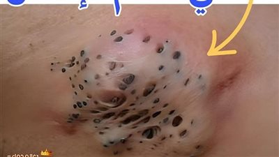 هل تعرف ما هي أقذر منطقة في جســــم الإنسان؟ 