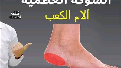  علاج الشوكة العظمية بـ ٦ وصفات من الطبيعة بدون أدوية