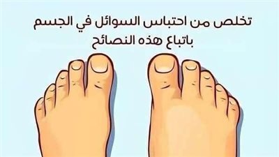 كيف تتخلص من احتباس السوائل في الجسم