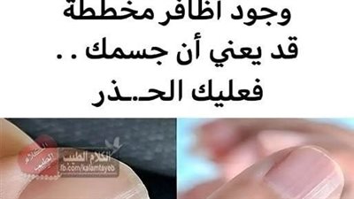 وجود أظافر مخططة قد يعني أن جسمك