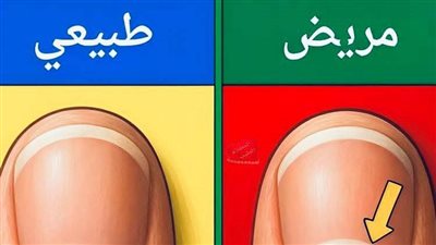 هل تساءلت يومًا ما هذا القوس الأبيض الموجود على الأظافر