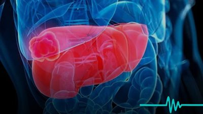 مشروبات ذهبية لتقليل دهون الكبد هل تعرفها