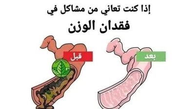 طريقة سحرية لتنظيف القولون من البراز المتحجر في يوم واحد ستخرج فضلات صلبة وسيختفي الإمساك نهائيا