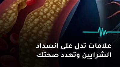10 علامات تحذيرية تدل على انسداد الشرايين وتهدد صحتك