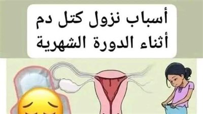ماذا يعني نزول كتل ډم متجمدة أثناء الدورة الشهرية للمرأة