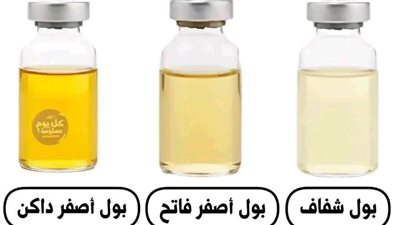 لون البول يدل علي حالتك الصحية