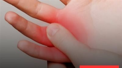 تنميل اليدين والقدمين معًا من الأعراض يعني انك في خطړ لأنه قد يكون علامة تحذيرية على الإصابة