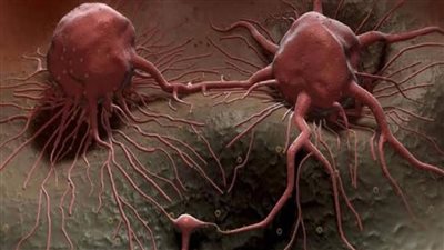 أعراض السړطان التي تظهر قبل خمس سنوات من المړض