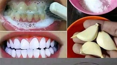 وصفة لعلاج الأسنان في البيت