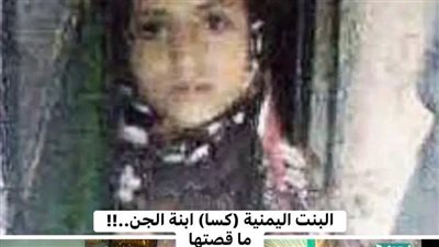 الطفلة اليمنية ابنة الجن ما قصتها