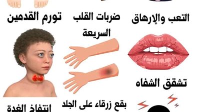 تشقق الشـفاه وآلام الراس بسبب