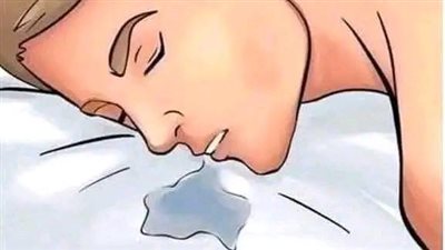 سـيلان الفم