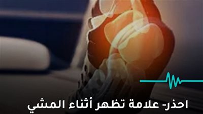 احذر علامة تظهر أثناء المشي تدل على ارتفاع الكوليسترول