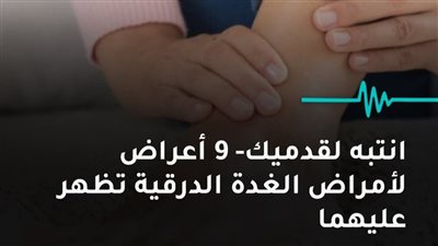 انتبه لقدميك 9 أعراض لأمراض الغدة الدرقية تظهر عليهما