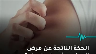الحكة الناتجة عن مرض السكري أسبابها وطرق علاجها