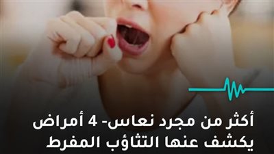 أكثر من مجرد نعاس 4 أمراض يكشف عنها التثاؤب المفرط